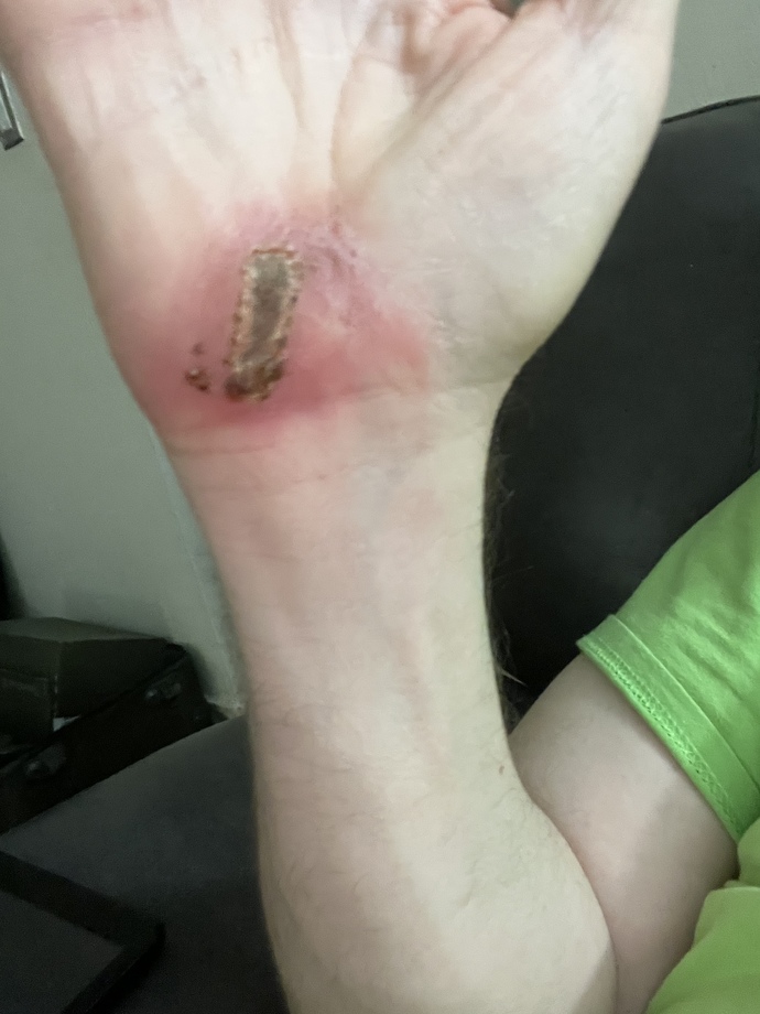 What does it mean when a guy wants to show you his injury?