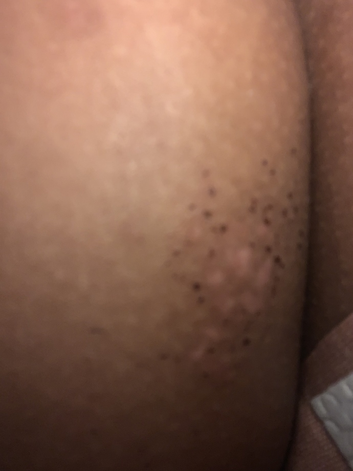 Is this a rash?