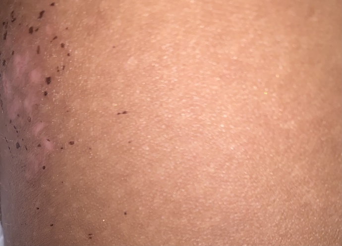 Is this a rash?