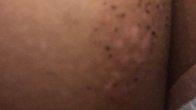 Is this a rash?