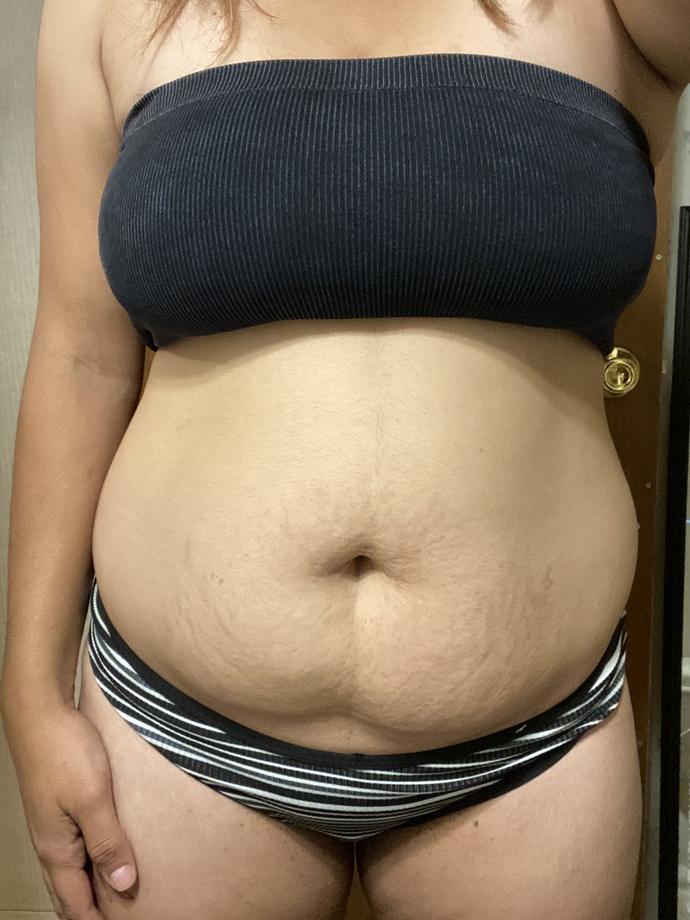 How do I look postpartum?