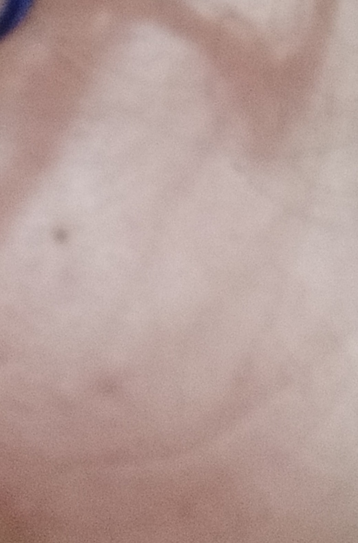 What do you think of birthmarks? Do you have a birthmark?