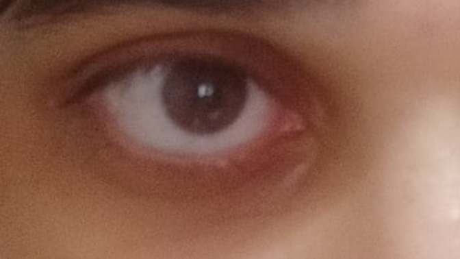 Would you date someone with dark circles?