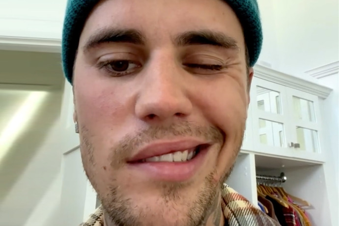 Justin Bieber Revealed He Has Ramsay Hunt Syndrome :(