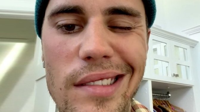 Will God fix Justin Bieber's wacky paralyzed face?