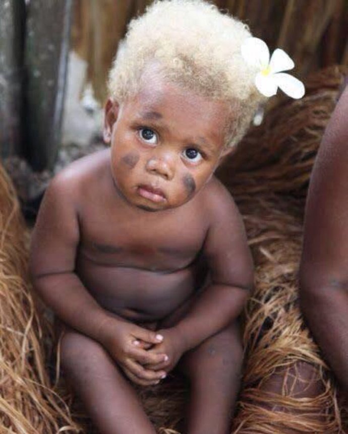 Blonde African gene or European Gene? Where do you think the son most likely got golden hair from? From the Persian mom or seemingly Black dad?