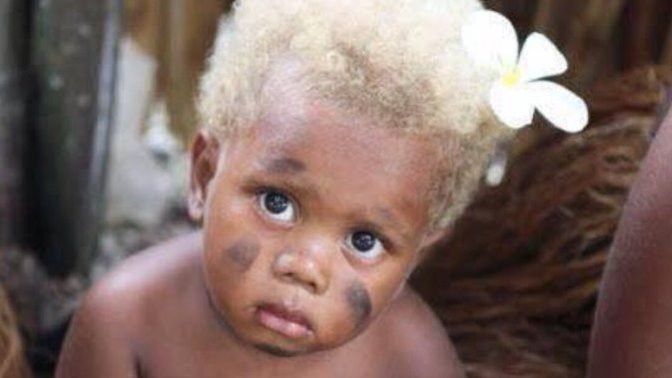 Blonde African gene or European Gene? Where do you think the son most likely got golden hair from? From the Persian mom or seemingly Black dad?
