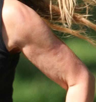 Guys: Is cellulite a turn off for you?