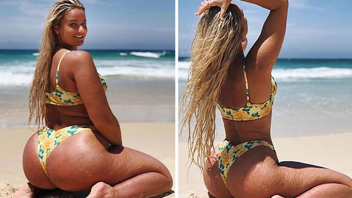 Guys: Is cellulite a turn off for you?