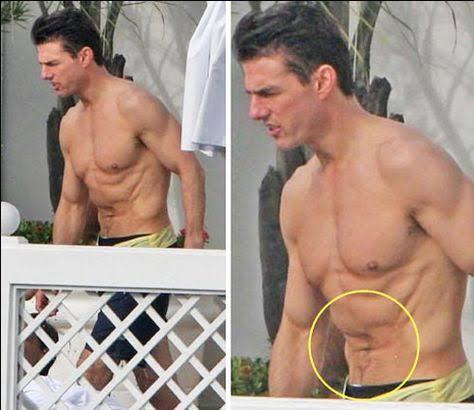 Guys: Is cellulite a turn off for you?