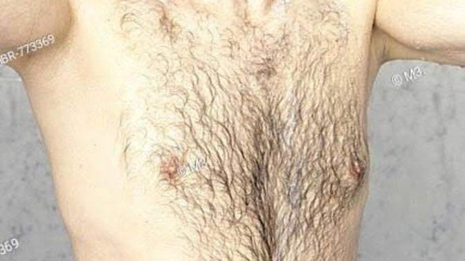 Girls, Is male body hair a turn off for you?