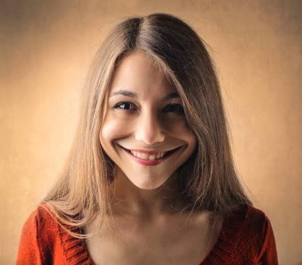 At what point does smiling become too much?