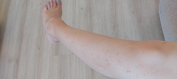 Spots on my leg?