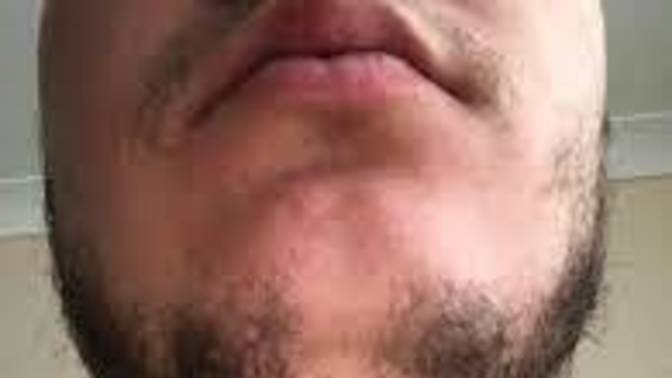 Why do guys who can't grow much facial hair still grow some?