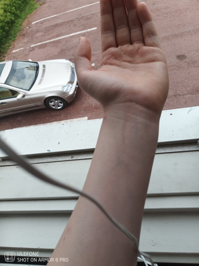 Do I have cool, warm or neutral skin undertone?