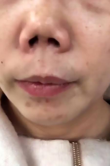 Would you date someone with pig nose?