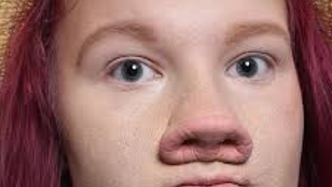 Would you date someone with pig nose?