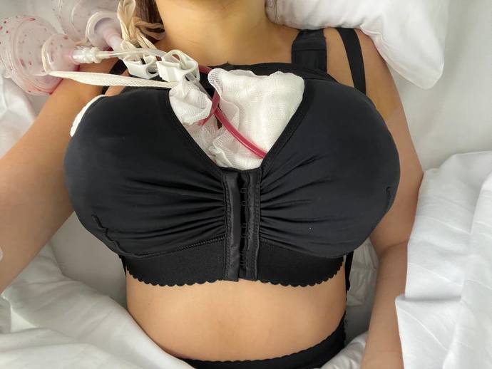 My boyfriend didnt like big breasts in sex. We broke up, now hes biting his nails