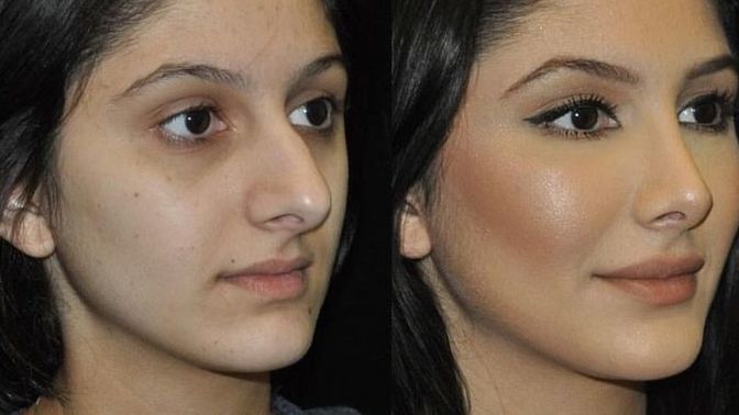 Men, what are your opinions on women who get nose jobs?