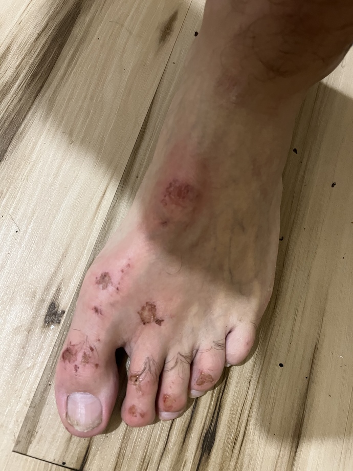 What’s the most painful thing you’ve ever experienced?
