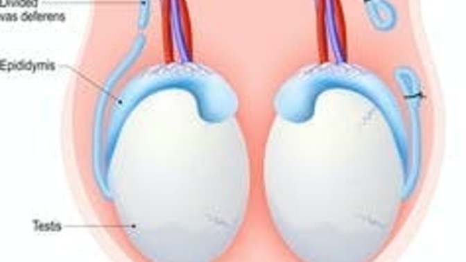 Should Pro choice/Abortion men get vasectomies in support?