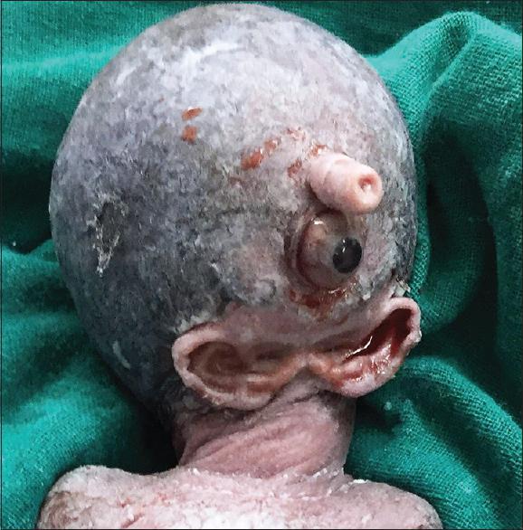 Do you think he should thank his mother for not aborting him?