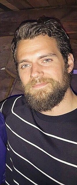 What are some imperfections that you find attractive?