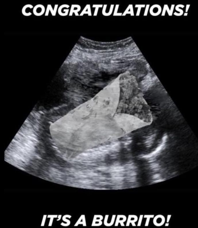 Have you ever had an ultrasound?