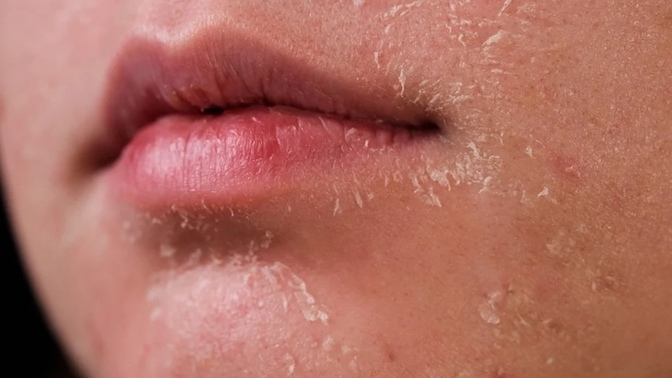 Does anyone know how a I can treat dry skin?