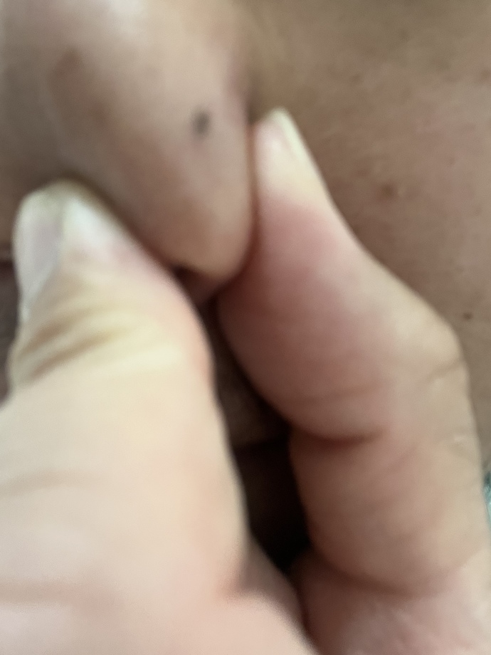 How to get rid of this black dot on my side nose anyone?