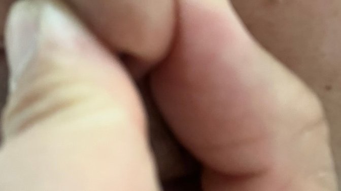 How to get rid of this black dot on my side nose anyone?