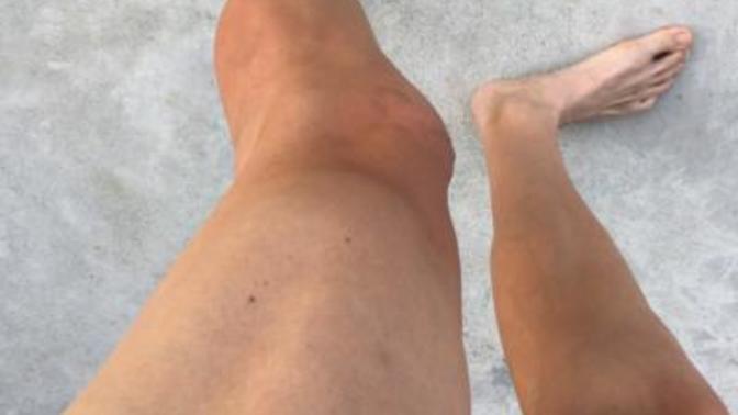 Girls, As a woman do you think you'd still prefer hairy legs or shaved?