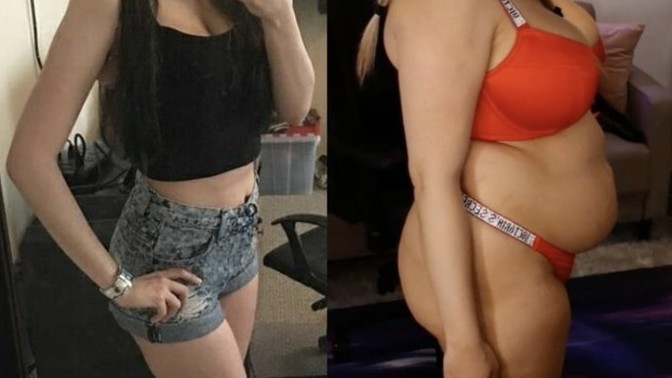 Is this weight gain reversible?