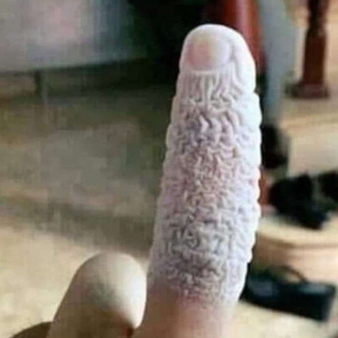 Does anyone else wake up with a wrinkly finger?