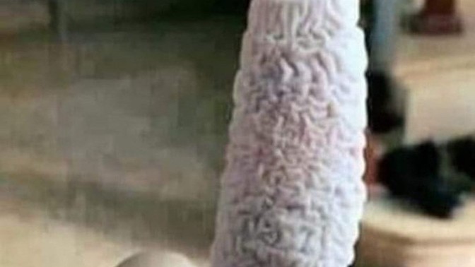 Does anyone else wake up with a wrinkly finger?