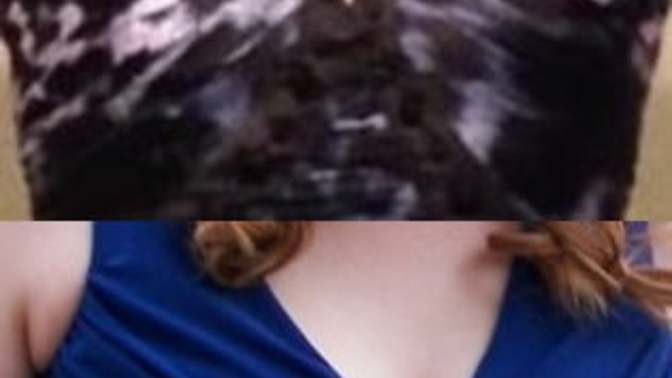 Why did my breasts shrink from D cups to A cups with weight loss?