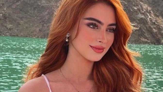 Does she look like a natural RED HEAD / GINGER?