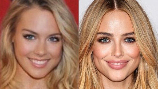 Do you think this woman had plastic surgeries or not?