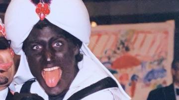 People whine about the "orange Cheeto" but those same people never say anything about the "black soyface."