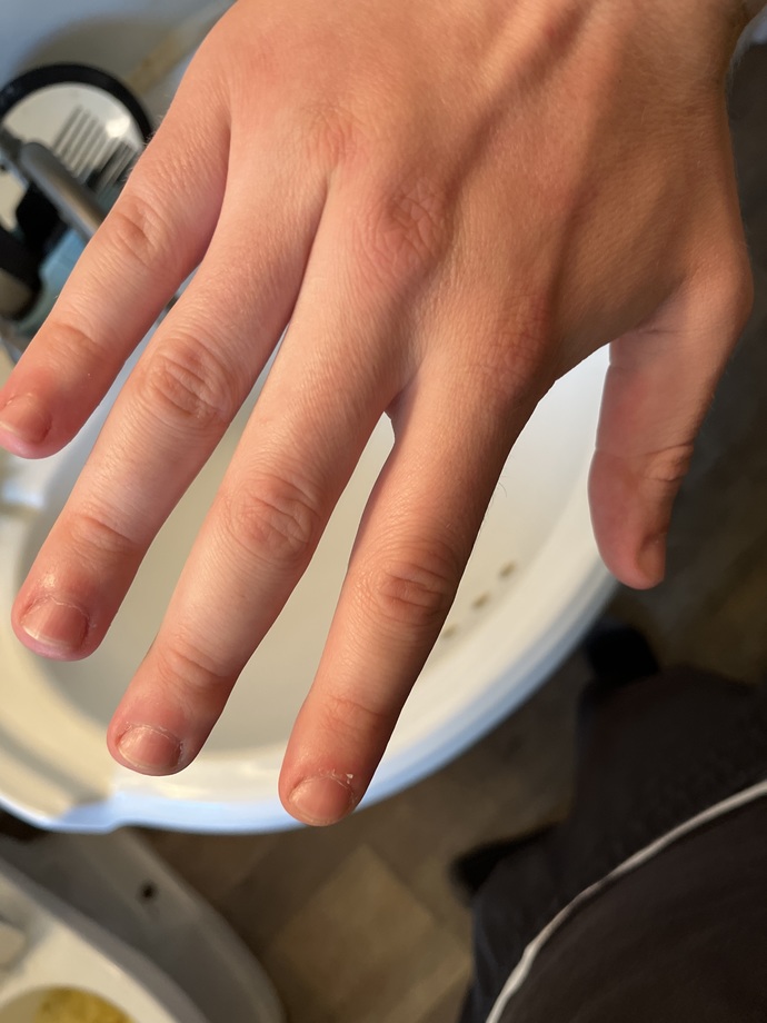 Got told I got female fingers, wtf does that mean?
