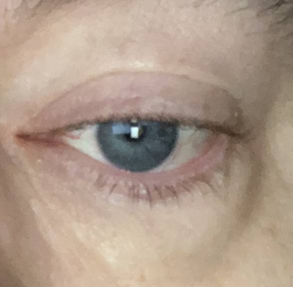 What color are your eyes?