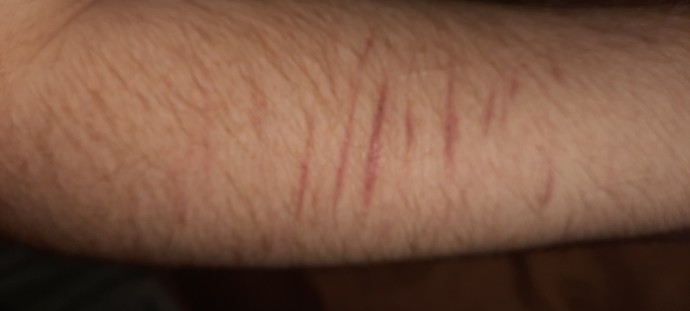 How to hide scars?