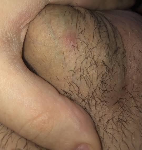 Do you keep the hair private parts or shave it?