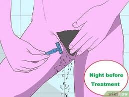 Do you keep the hair private parts or shave it?