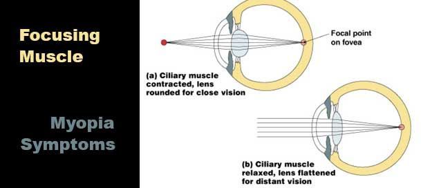 Would you get Lasik, knowing there could be complications?