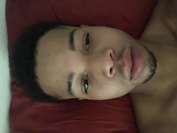 Why does my left eye do this? and is it disgusting?