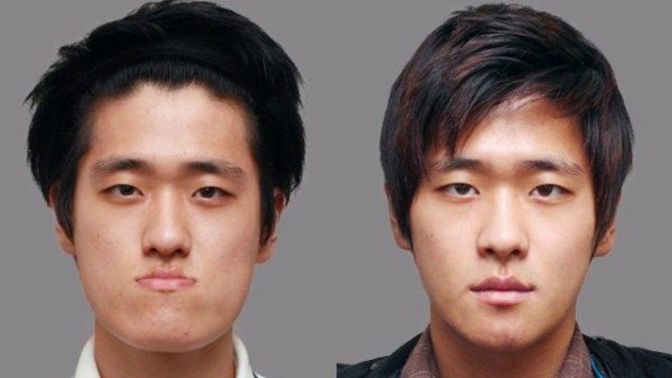 Should more men get plastic surgeries if they are unhappy with their looks?
