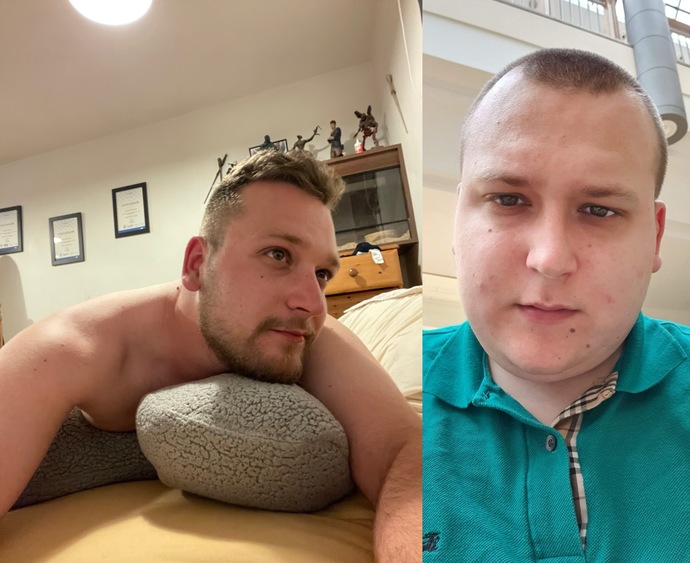 Seeing how differently women treat me now my appearance has improved made me realise how shallow and superficial women are, can you see why?