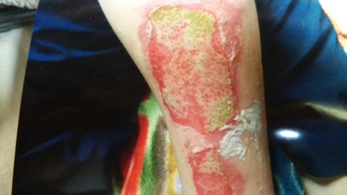 Is this going to leave a scar?