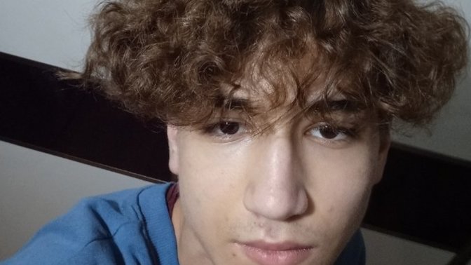 How can ı Fix the Facial volume loss?